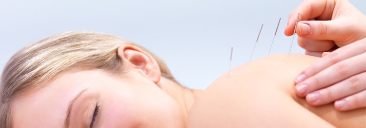 Chiropractic Lakeville MN Acupuncture